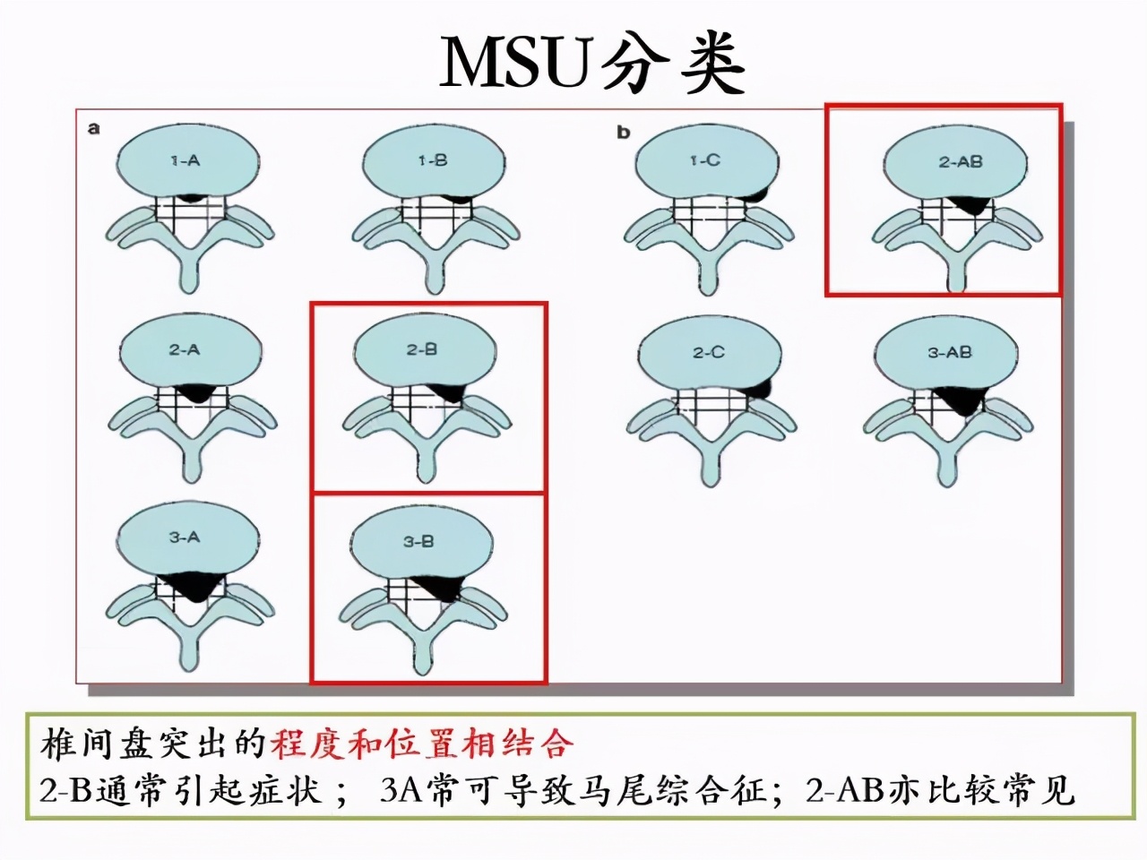 腰椎增生和腰间盘突出哪个更严重,腰椎间盘突出3毫米5毫米严重吗