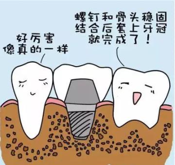 种植牙影响核磁共振和脑ct吗,种植牙影响核磁共振和ct吗