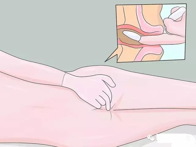 直肠栓剂的正确使用方法视频,直肠栓剂操作教学