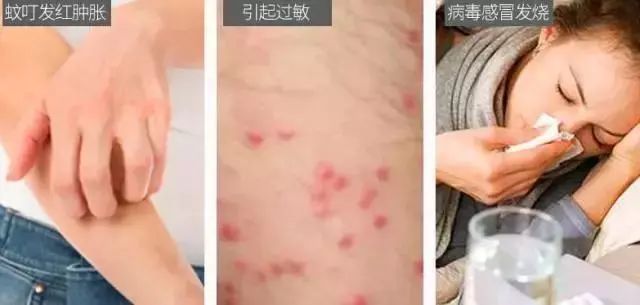 灭蚊灯中的终结者！纯物理灭蚊，无毒无味，孕妇孩子都可用