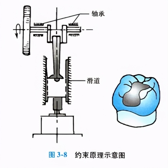 牙齿缺损修复去哪家牙科医院,牙科门牙缺损修复照片