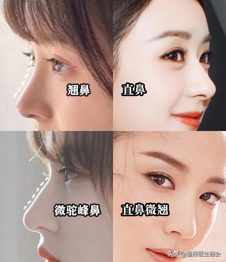 直鼻、直鼻微翘、翘鼻、微驼峰，好看的鼻子怎么选？