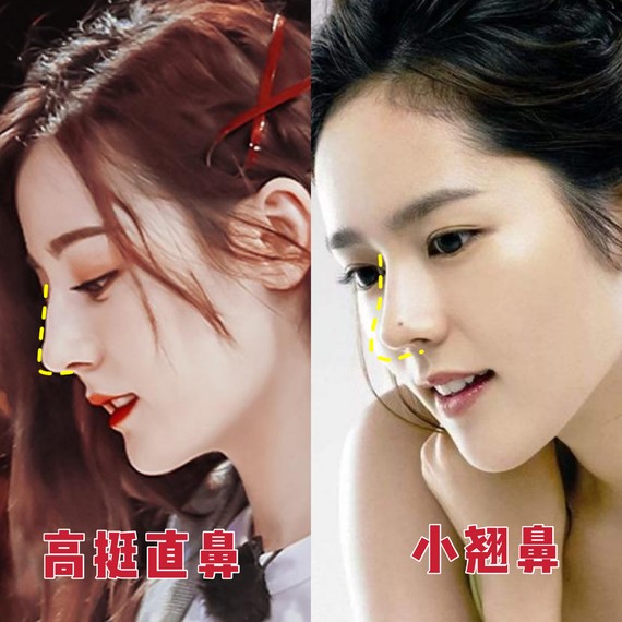 好看的鼻子类型驼峰鼻,好看的鼻型有哪几种