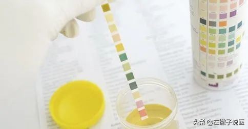 尿常规化验单怎么看才能看懂,尿常规检查报告看不懂怎么查