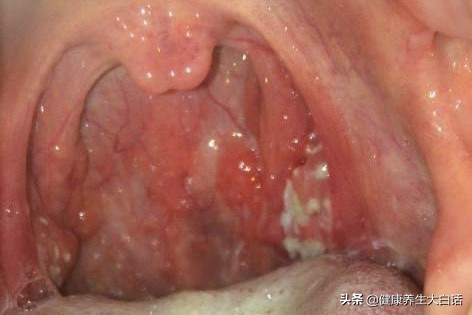 小病缠身怎么办,小病缠身怎么缓解