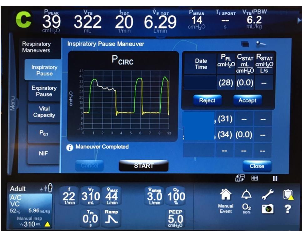 新冠肺炎机械通气系列课程(讲义)-阻塞性肺病的机械通气