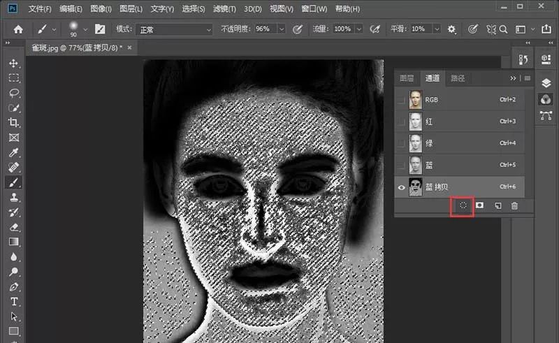 祛除脸部雀斑最有效的方法,有什么日常方法可以去除脸上雀斑