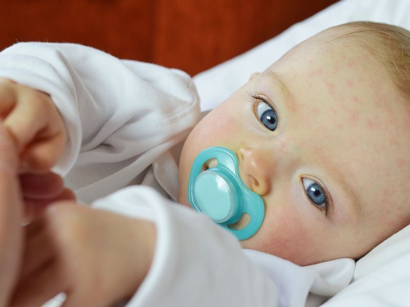 过敏体质的宝宝如何选益生菌,过敏宝宝可以一直喝过敏益生菌吗