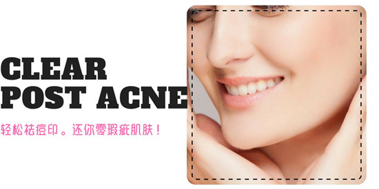 真正好用的祛痘印产品排行榜10强,祛痘祛印有什么好用产品