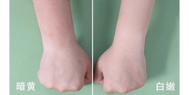 j-style冰点脱毛仪,j-style光子嫩肤脱毛仪