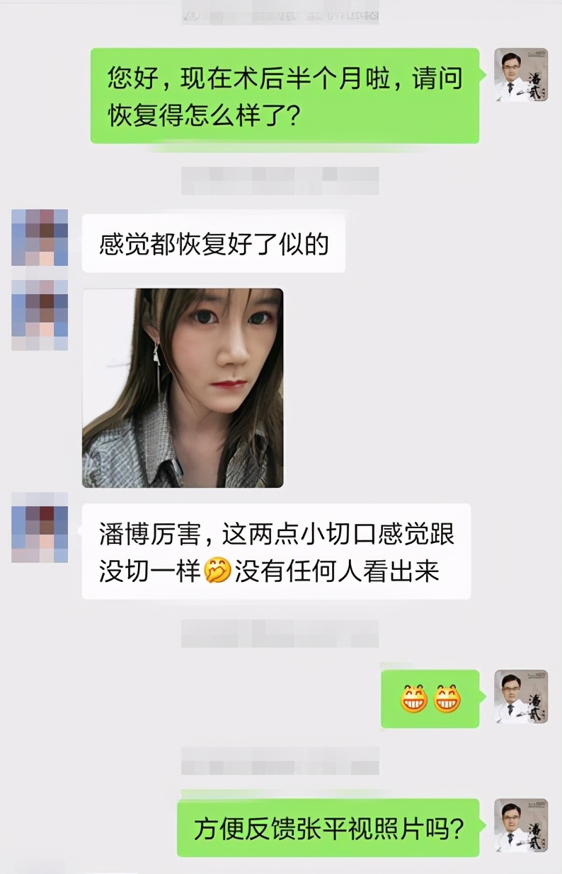 广州双眼皮凹陷修复视频,小切口双眼皮肉条修复