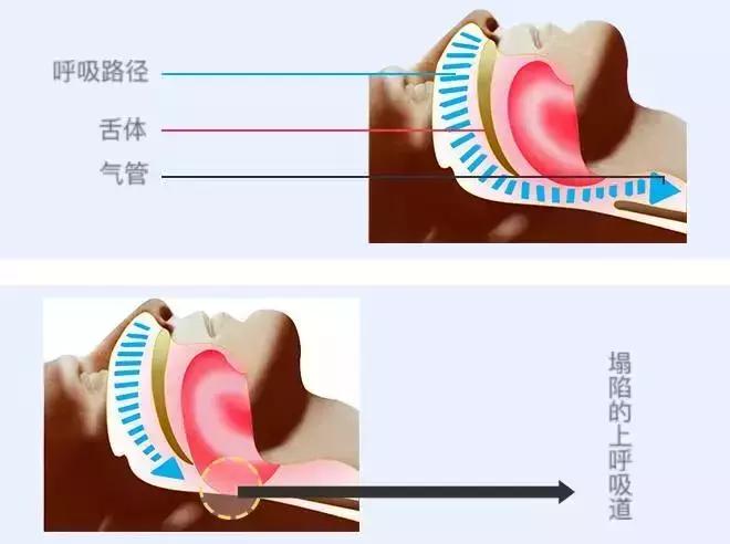 再打呼噜，我就要给你带个紧箍咒！