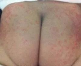 月子里最揪心的几件事,月子里最痛苦的事是什么