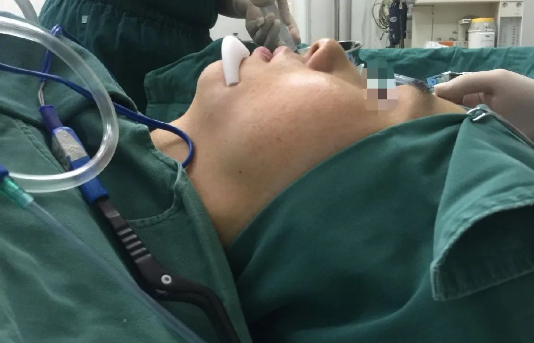 下巴什么假体可以避免骨吸收,假体隆下巴会割断唇系带吗