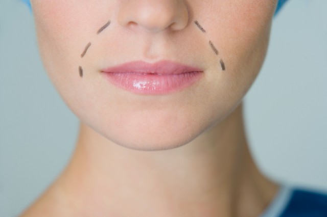 如何消除脸上的法令纹小妙招,怎样消除脸上的法令纹最有效