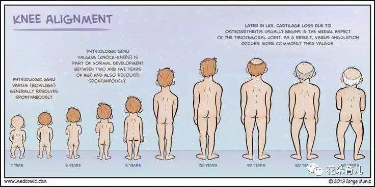 宝宝腿什么样需要矫正,怎么判断宝宝腿型是否正常
