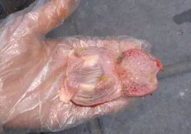 鸡瘟软脚怎么治疗,鸡瘟和霍乱的症状及治疗