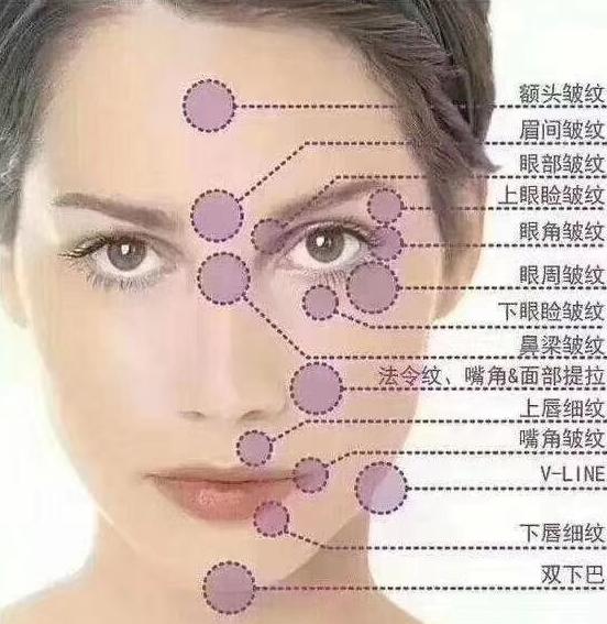 线雕是面部提升最好的方法吗,面部提升最好的方法是线雕吗