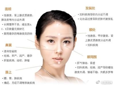 长斑了不用慌了解根源最重要,突然发现长斑了赶紧补救可以吗