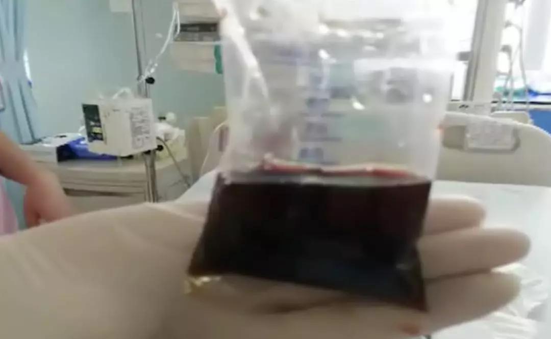 3岁宝宝高烧不退输液,疫情期间3岁宝宝高烧不退