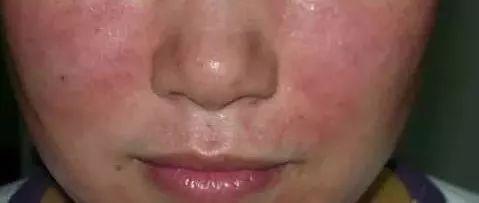 效果很快的护肤品安全吗,效果特别好的护肤品有激素吗