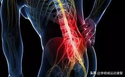 腰痛了最快恢复方法,你的腰还好吗是什么意思