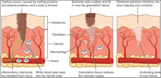 难看又难缠的肥胖纹，要如何预防和去除呢？