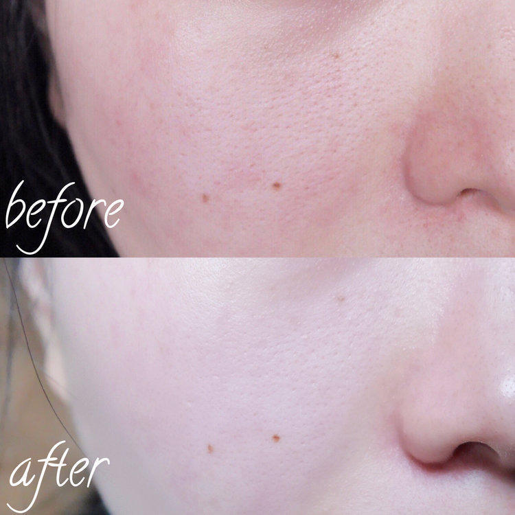 脸部缺水敷面膜刺痛是怎么办,脸部缺水贴面膜会刺痛是怎么回事