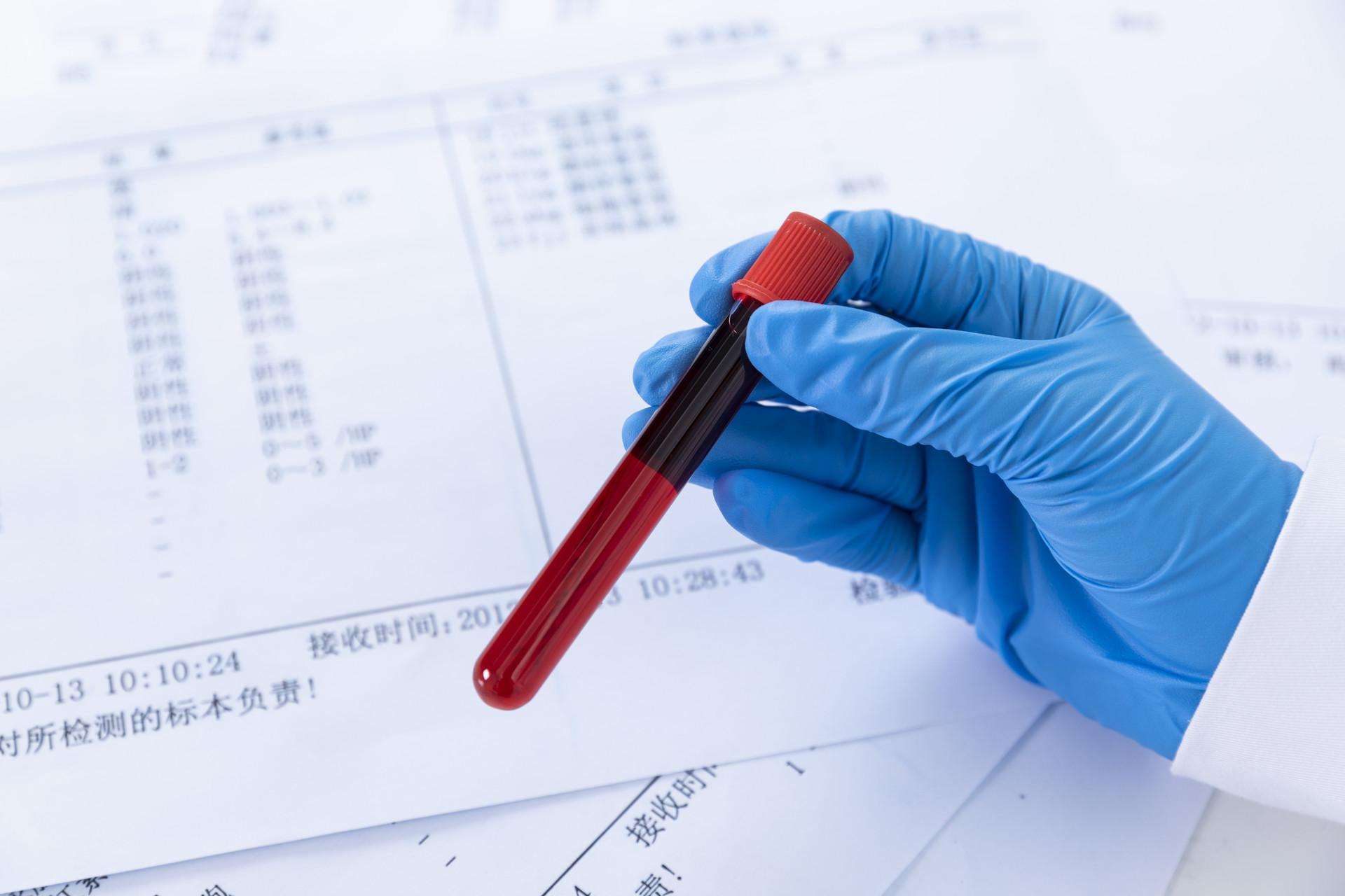 尿糖与糖尿病的区别,糖尿病人尿糖四个加号意味着什么