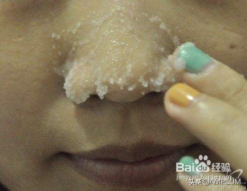 脸上黑头怎么消除小妙招,有黑头怎么办生活小妙招