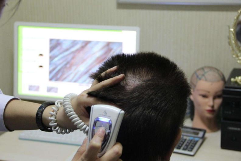 发质差要怎么养,发质太差怎么补救最快