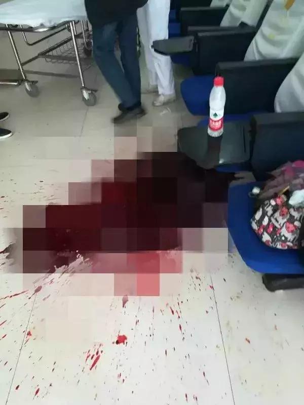 一男子喝酒吐血2000毫升,男子喝酒突然吐血是怎么回事