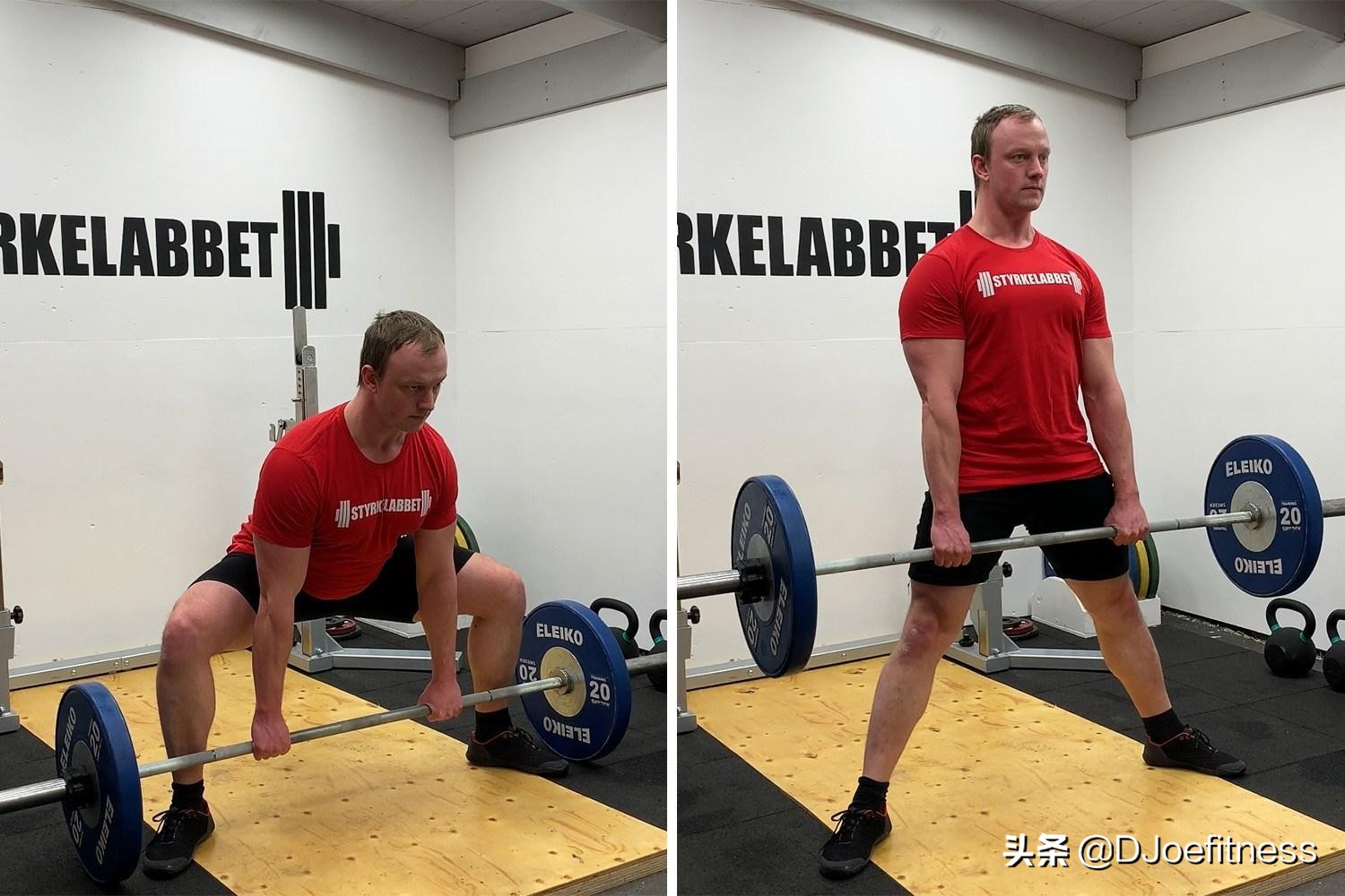 腰部损伤能好吗,腰受伤了以后还能做硬拉吗