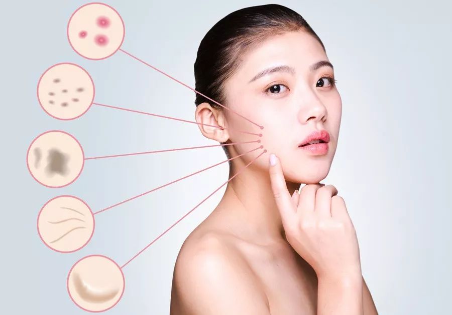 果酸祛痘印真实效果图,果酸换肤祛痘印对比图