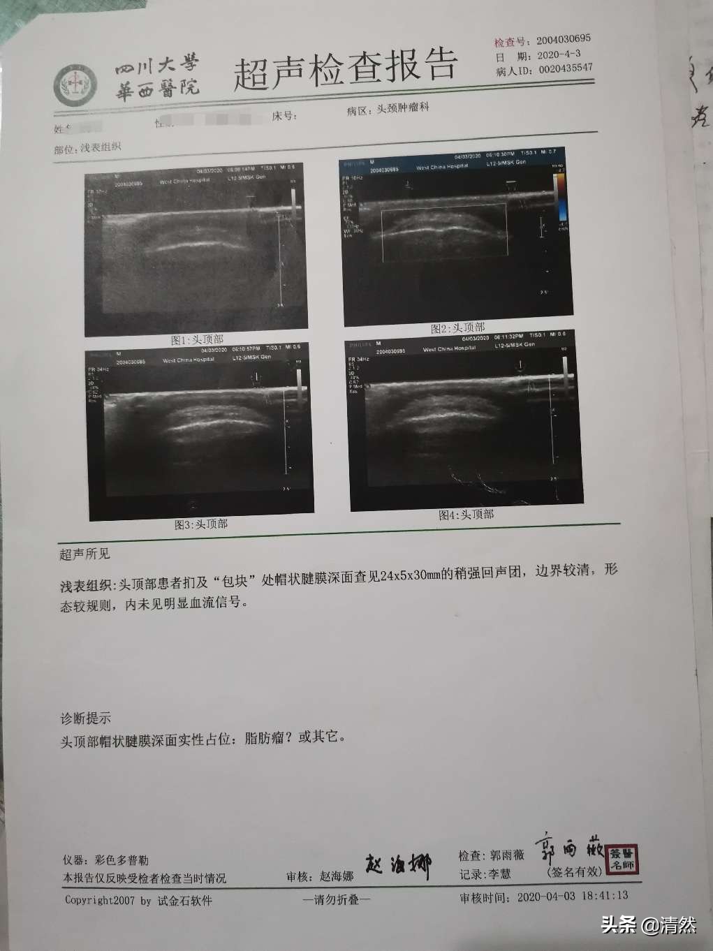 华西坝黄花风铃,我与华