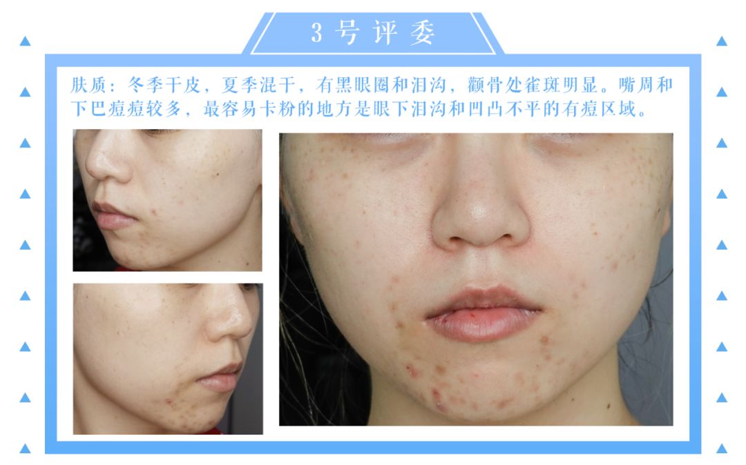 「Foundation101」遮瑕组在线battle!谁才是水煮蛋之王？（上）