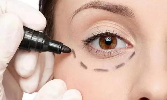 眼袋显老10岁三种方法帮助改善,眼袋显老怎么解决