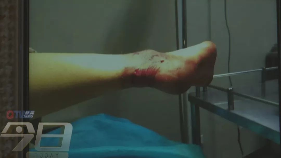 娲椾釜婢℃妸鎵嬫憯鏂簡8鏍圭瓔,娲椾釜婢℃憯浜嗕竴璺ら鎶樹簡