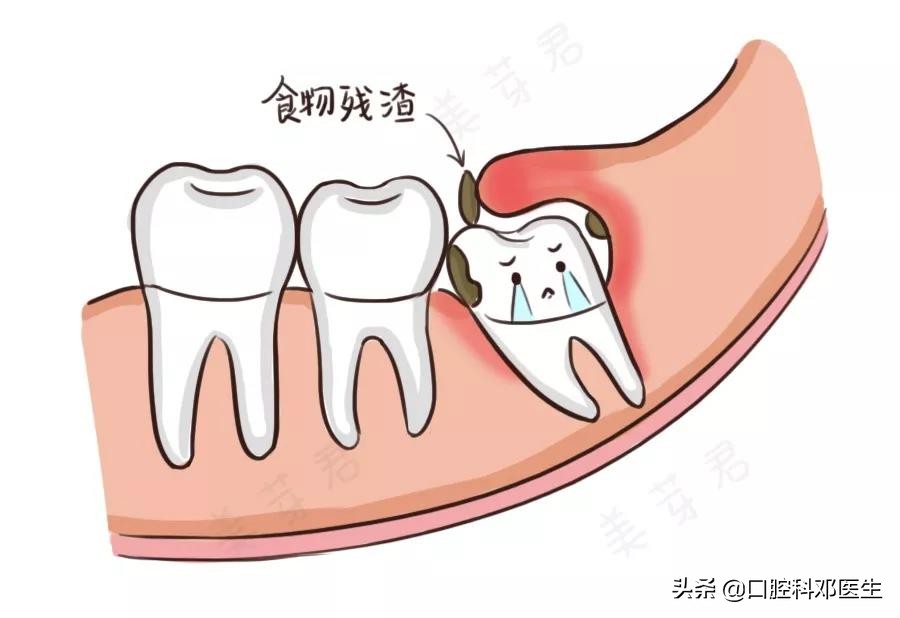 新型冠状病毒肺炎患者怎么治疗,新肺炎疫情有无治疗方法