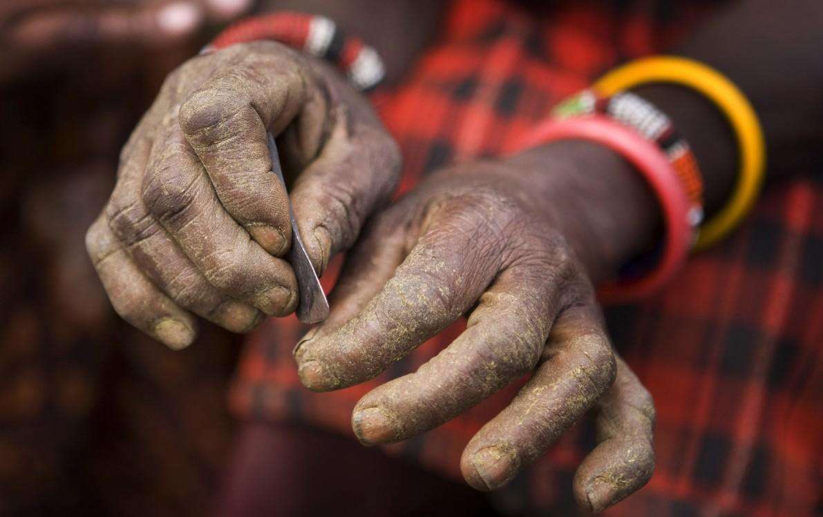 阉割文化哪家强？阉割动物与阉割人类的互动关系