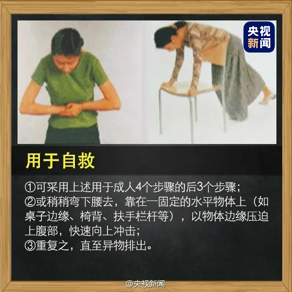 儿童异物卡喉梗阻窒息急救法,孩子被异物卡喉怎么做手术