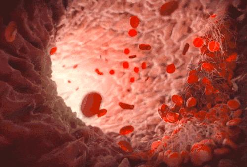 小编推荐一些健康食物,溶栓降脂吃什么好