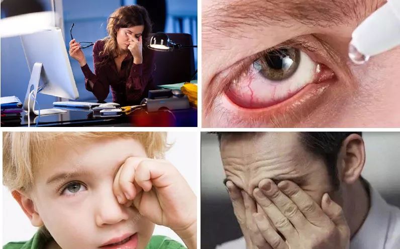 景甜同款洗眼睛水,景甜推荐的网红洗眼液