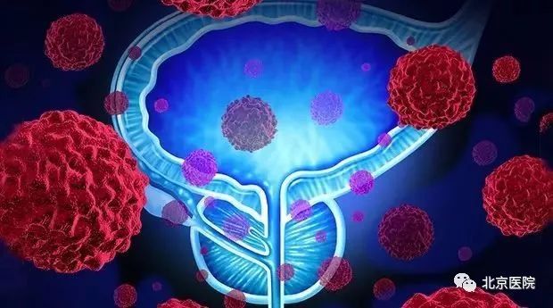 第12届北京医院前列腺癌患者俱乐部活动通知