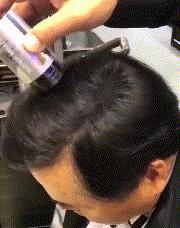 一天掉多少根头发算脱发,掉多少根头发就属于脱发了