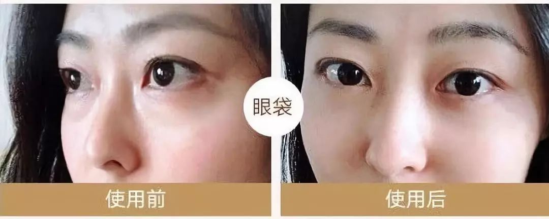 马应龙八宝眼袋型眼膜,马应龙八宝多肽眼膜