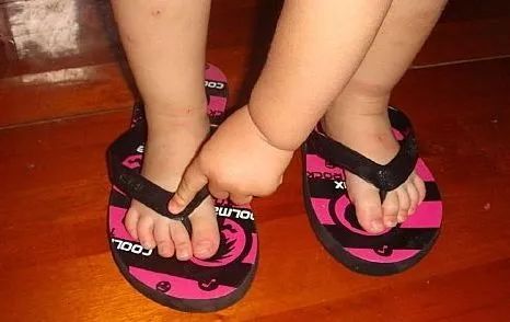 治疗脚气烂脚丫的小妙招,如何治疗脚臭脚气脚后跟开裂