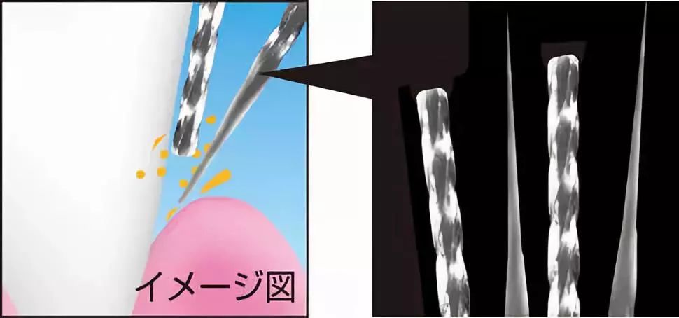 双十一我最先放入购物车的，就是这几款风靡日本的牙刷！