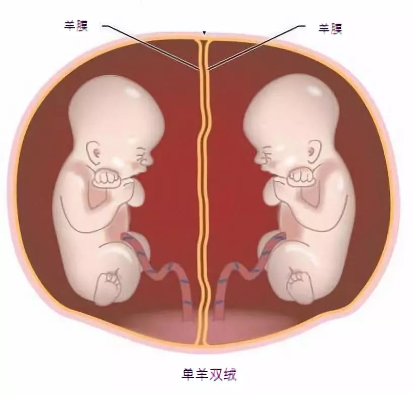 40岁生双胞胎的风险,双胞胎风险真的很大吗