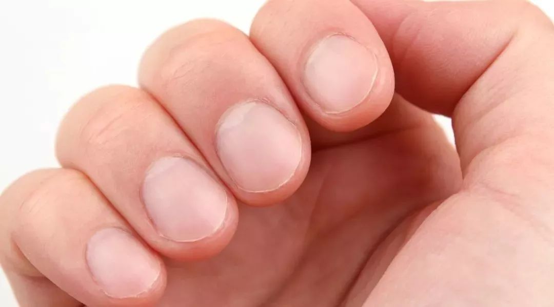 指甲上月牙越来越少是怎么回事,指甲上月牙少代表什么原因